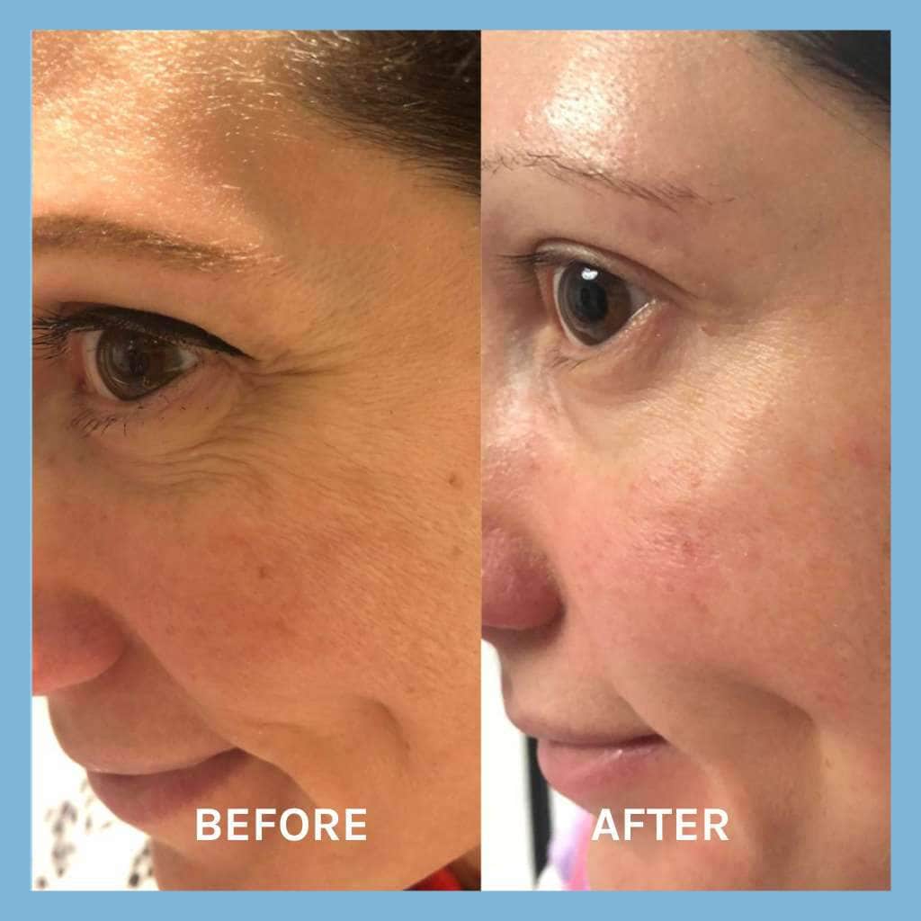 Age Defying Lifting Serum - Travel Size - Image 6